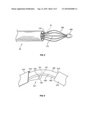 METHOD FOR TREATING AN ASTHMA ATTACK diagram and image