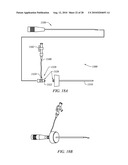 ELECTROSURGICAL METHOD AND APPARATUS FOR REMOVING TISSUE WITHIN A BONE BODY diagram and image