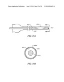 ELECTROSURGICAL METHOD AND APPARATUS FOR REMOVING TISSUE WITHIN A BONE BODY diagram and image