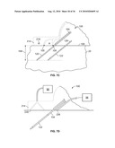 METHODS FOR APPLYING ENERGY TO TISSUE USING A GRAPHICAL INTERFACE diagram and image