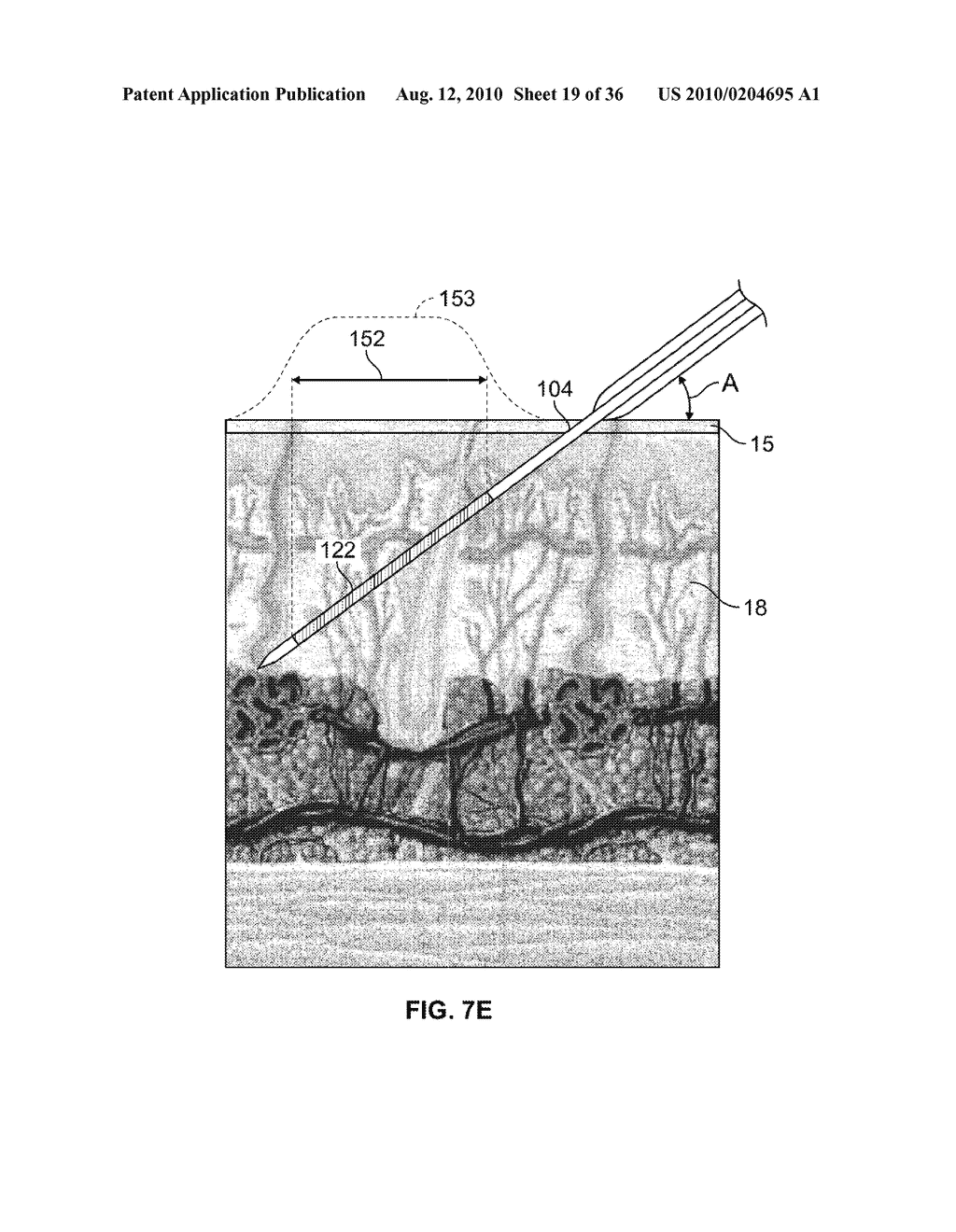 METHODS FOR APPLYING ENERGY TO TISSUE USING A GRAPHICAL INTERFACE - diagram, schematic, and image 20