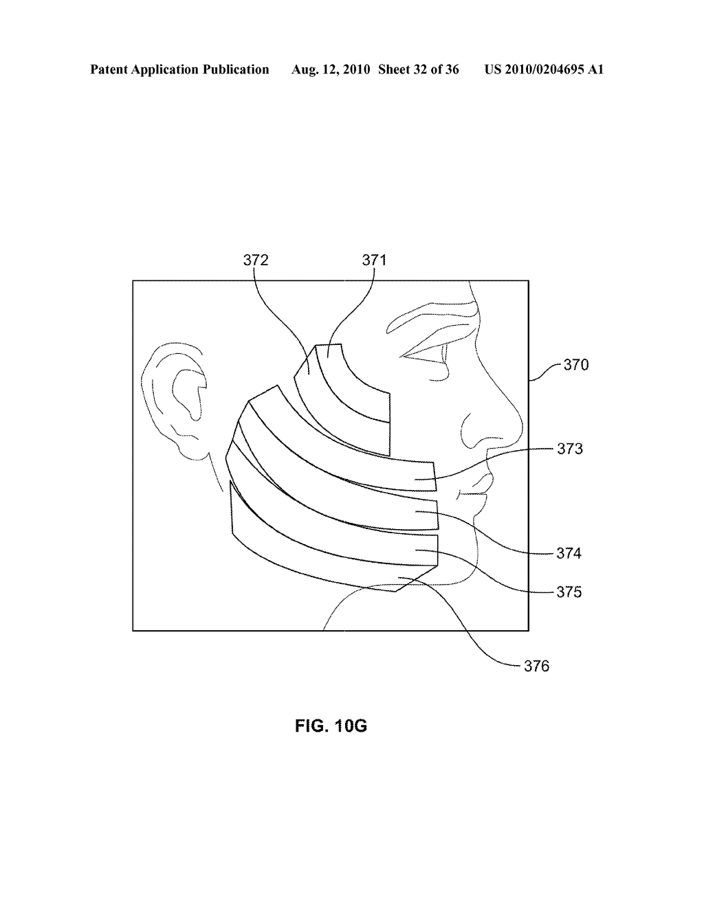 METHODS FOR APPLYING ENERGY TO TISSUE USING A GRAPHICAL INTERFACE - diagram, schematic, and image 33