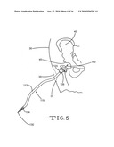 PRECISION ASSEMBLEABLE SURGICAL TOOL HANDLE diagram and image