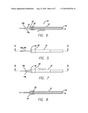 Intracorneal Lens Insertion Device diagram and image