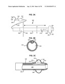 SURGICAL INSTRUMENTS FOR CREATING A PNEUMOSTOMA AND TREATING CHRONIC OBSTRUCTIVE PULMONARY DISEASE diagram and image