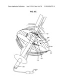 SURGICAL INSTRUMENTS FOR CREATING A PNEUMOSTOMA AND TREATING CHRONIC OBSTRUCTIVE PULMONARY DISEASE diagram and image