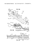 SURGICAL INSTRUMENTS FOR CREATING A PNEUMOSTOMA AND TREATING CHRONIC OBSTRUCTIVE PULMONARY DISEASE diagram and image