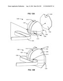 SURGICAL INSTRUMENTS FOR CREATING A PNEUMOSTOMA AND TREATING CHRONIC OBSTRUCTIVE PULMONARY DISEASE diagram and image