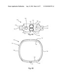 INTERVERTEBRAL IMPLANT WITH INTEGRATED FIXATION diagram and image