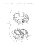 INTERVERTEBRAL IMPLANT WITH INTEGRATED FIXATION diagram and image