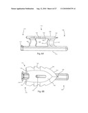 INTERVERTEBRAL IMPLANT WITH INTEGRATED FIXATION diagram and image