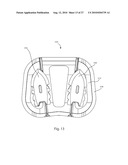 INTERVERTEBRAL IMPLANT WITH INTEGRATED FIXATION diagram and image