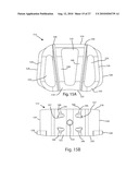 INTERVERTEBRAL IMPLANT WITH INTEGRATED FIXATION diagram and image