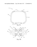 INTERVERTEBRAL IMPLANT WITH INTEGRATED FIXATION diagram and image