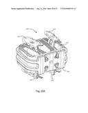 INTERVERTEBRAL IMPLANT WITH INTEGRATED FIXATION diagram and image