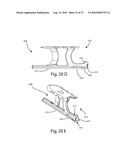 INTERVERTEBRAL IMPLANT WITH INTEGRATED FIXATION diagram and image