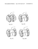 INTERVERTEBRAL IMPLANT WITH INTEGRATED FIXATION diagram and image