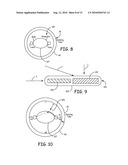 METHODS AND APPARATUS FOR REDUCING SPURIOUS SIGNALS IN IMPLANTABLE MEDICAL DEVICES CAUSED BY X-RAY RADIATION diagram and image