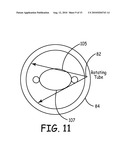 METHODS AND APPARATUS FOR REDUCING SPURIOUS SIGNALS IN IMPLANTABLE MEDICAL DEVICES CAUSED BY X-RAY RADIATION diagram and image