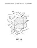 Chemical Mechanical Vapor Deposition Device for Production of Bone Substitute Material diagram and image