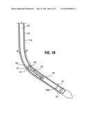 Tools and Methods Useful with Wellbore Reverse Circulation diagram and image