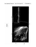 Respiratory Motion Compensated Cardiac Wall Motion Determination System diagram and image