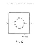 ROTATION CENTER IDENTIFYING METHOD, RING ARTIFACT CORRECTION METHOD, ROTATION CENTER IDENTIFYING APPARATUS, X-RAY DIAGNOSTIC APPARATUS, RECORDING MEDIUM ON WHICH PROGRAM FOR EXECUTING ROTATION CENTER IDENTIFICATION IS RECORDED AND RECORDING MEDIUM ON WHICH PROGRAM FOR EXECUTING RING ARTIFACT CORRECTION IS RECORDED diagram and image