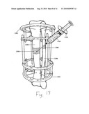 ENHANCED MEDICAL IMPLANT diagram and image