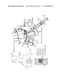 ENHANCED MEDICAL IMPLANT diagram and image