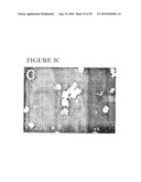 Use of SDF-1 to Improve Ischemic Myocardial Function diagram and image