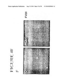 Use of SDF-1 to Improve Ischemic Myocardial Function diagram and image