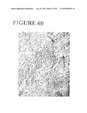 Use of SDF-1 to Improve Ischemic Myocardial Function diagram and image