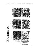 Use of SDF-1 to Improve Ischemic Myocardial Function diagram and image