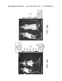 ADHERENT CELLS FROM ADIPOSE OR PLACENTA TISSUES AND USE THEREOF IN THERAPY diagram and image