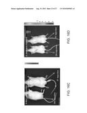 ADHERENT CELLS FROM ADIPOSE OR PLACENTA TISSUES AND USE THEREOF IN THERAPY diagram and image