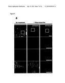 METHOD FOR TREATING DISEASES RELATED TO MITOCHONDRIAL DYSFUNCTION diagram and image