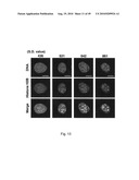 Nuclear localization of Src-family tyrosine kinases is required for growth factor-induced euchromatinization diagram and image