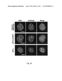 Nuclear localization of Src-family tyrosine kinases is required for growth factor-induced euchromatinization diagram and image