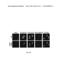 Nuclear localization of Src-family tyrosine kinases is required for growth factor-induced euchromatinization diagram and image