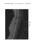 PHOTOCHEMICAL ACTIVATION OF SURFACES FOR ATTACHING BIOMATERIAL diagram and image