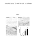 COMPOSITIONS AND TREATMENTS FOR SEIZURE-RELATED DISORDERS diagram and image