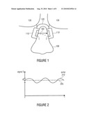 Apparatus and Method for Detecting at Least One Vital Parameter of a Person; Vital Parameter Detection System diagram and image