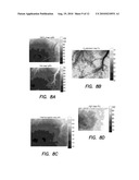 METHOD FOR PERFORMING QUALITATIVE AND QUANTITATIVE ANALYSIS OF WOUNDS USING SPATIALLY STRUCTURED ILLUMINATION diagram and image