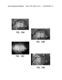 METHOD FOR PERFORMING QUALITATIVE AND QUANTITATIVE ANALYSIS OF WOUNDS USING SPATIALLY STRUCTURED ILLUMINATION diagram and image