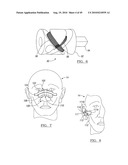 Method and Apparatus for Surgical Navigation diagram and image