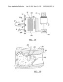 Method and Apparatus for Surgical Navigation diagram and image