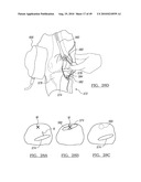 Method and Apparatus for Surgical Navigation diagram and image