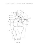 Method and Apparatus for Surgical Navigation diagram and image