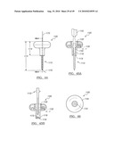 Method and Apparatus for Surgical Navigation diagram and image