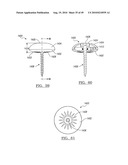 Method and Apparatus for Surgical Navigation diagram and image